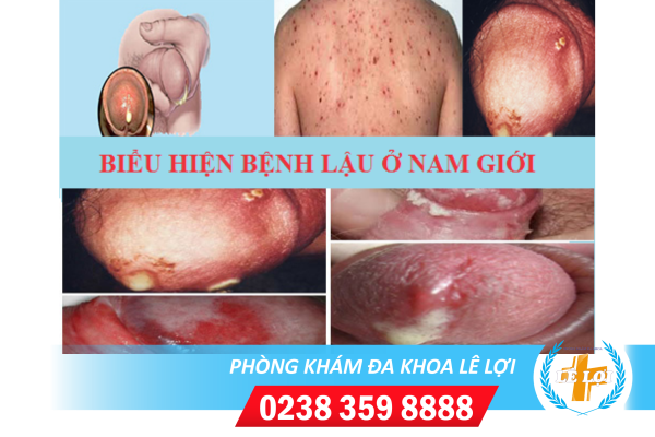 Nội dung đoạn văn bản của bạn (60)