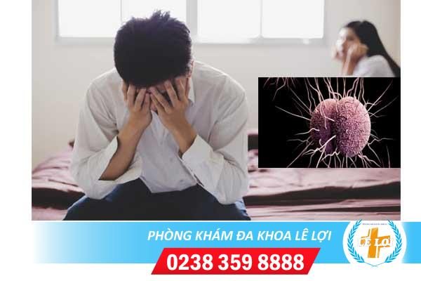 Các giai đoạn của bệnh lậu dấu hiệu nhận biết