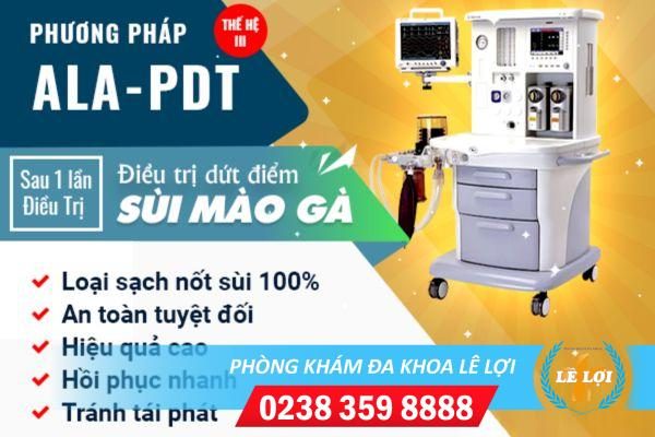 Biện pháp chữa sùi mào gà nữ hiệu quả hiện nay