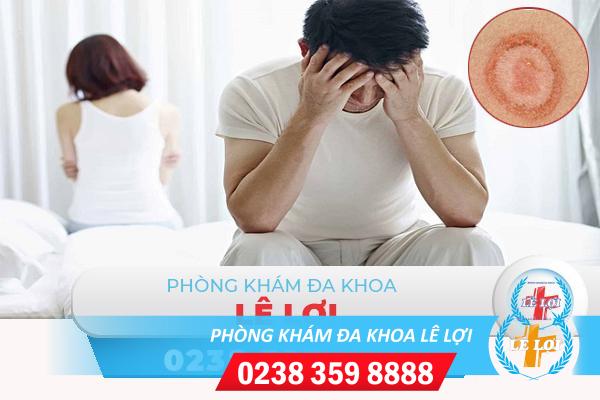 Săng giang mai là gì? dấu hiệu và cách điều trị