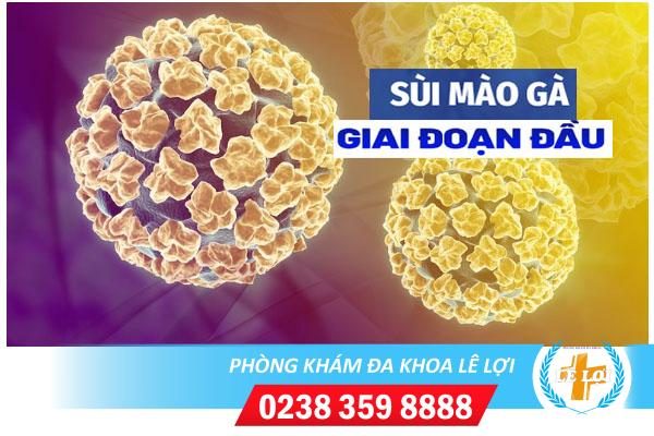 Biểu hiện sùi mào gà giai đoạn đầu là gì?