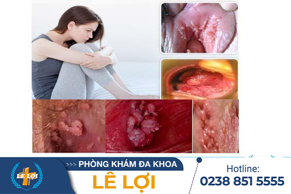 hinh-anh-sui-mao-ga-vung-kin-nu