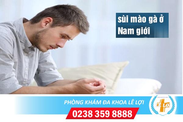 Hình ảnh dương vật bị sùi mào gà và cách điều trị