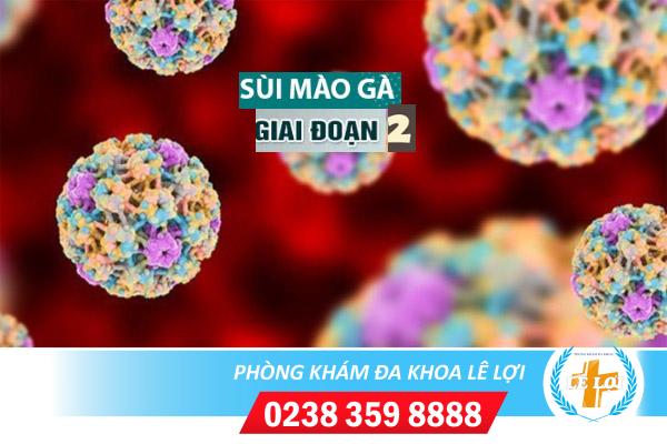 Sùi mào gà giai đoạn 2 triệu chứng và cách điều trị