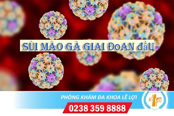 Sùi mào gà giai đoạn đầu dấu hiệu và cách chữa