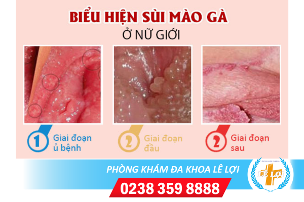 Nội dung đoạn văn bản của bạn - 2024-04-23T091135.901