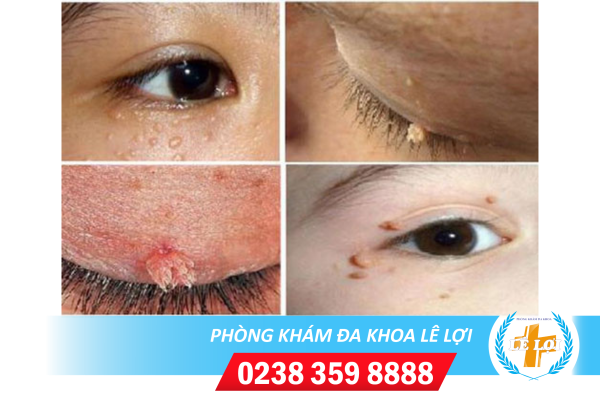 Nội dung đoạn văn bản của bạn (55)