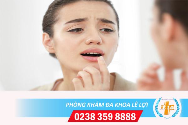 Biểu hiện bệnh lậu ở miệng và cách điều trị