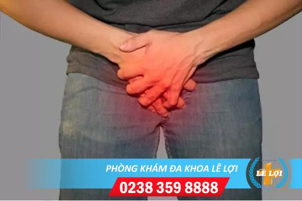 Những thông tin về bệnh sùi mào gà ở nam giới