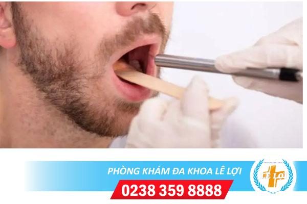 Khám lậu ở miệng tại Vinh