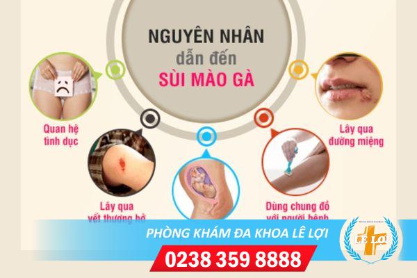 Sùi mào gà ở tinh hoàn nguy hiểm như thế nào?