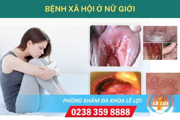 Bệnh xã hội ở nữ giới dấu hiệu và cách điều trị