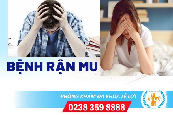 Bệnh rận mu là gì dấu hiệu nhận biết