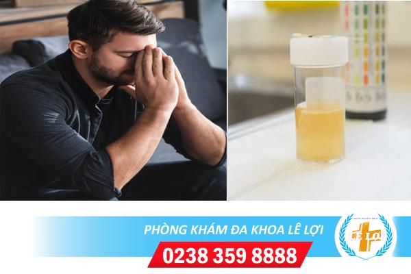 Đái ra dịch màu trắng ở nam giới là bị bệnh gì?