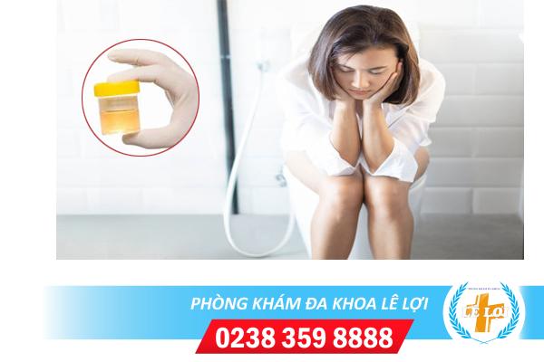 Tiểu buốt ra mủ là bệnh gì nguy hiểm không?