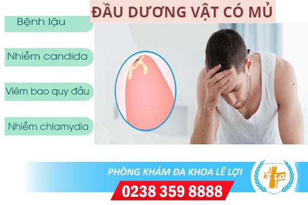 Đầu dương vật có mủ là bị gì phải làm sao?