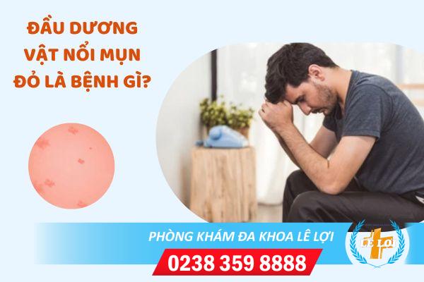 Đầu dương vật nổi mụn đỏ là bị gì?