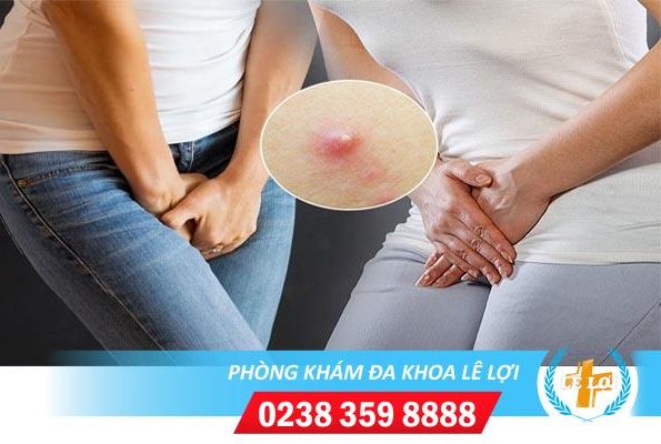 Nguyên nhân nổi mụn mủ trắng và cách trị hiệu quả