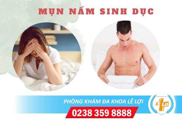 Dấu hiệu nhiễm mụn nấm sinh dục và cách chữa