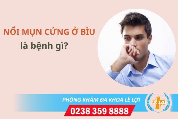 Nổi mụn cứng ở bìu là bị bệnh gì?