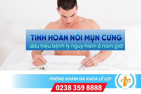 Tinh hoàn nổi mụn cứng nguy hiểm không?