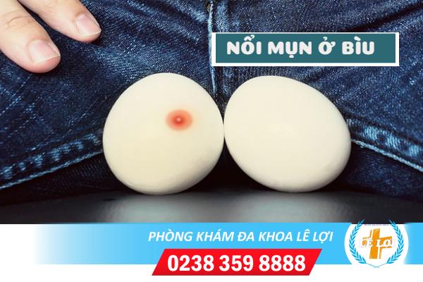 Nổi mụn ở bìu nguyên nhân và cách điều trị