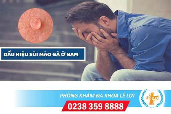 Dấu hiệu sùi mào gà ở nam và cách điều trị