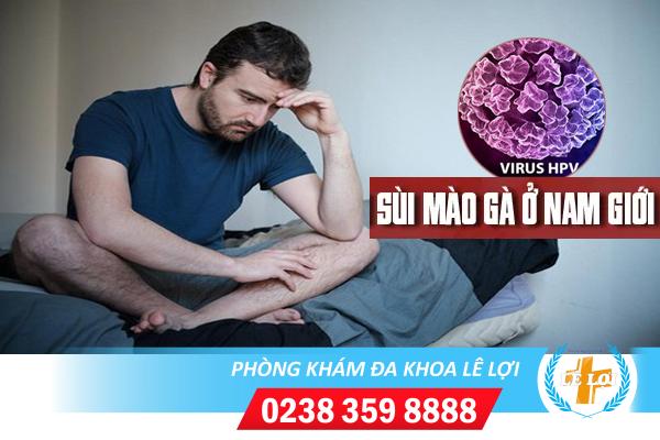 Triệu chứng bệnh sùi mào gà ở nam