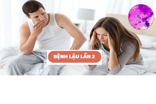 Bệnh lậu lần 2 dấu hiệu và cách điều trị