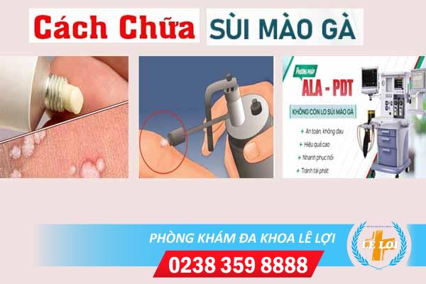 Sử dụng thuốc chữa sùi mào gà có mang lại hiệu quả?