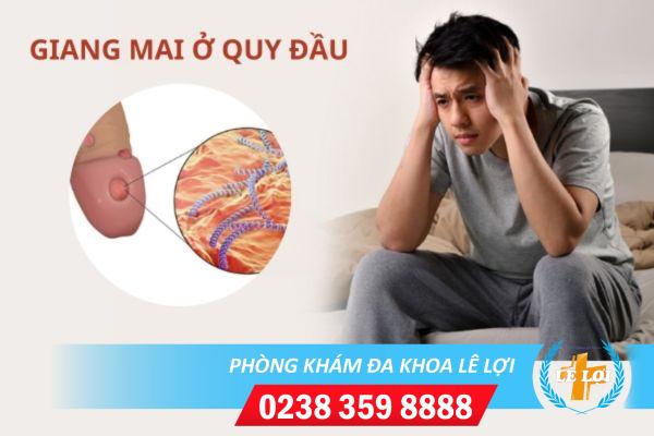 Dấu hiệu bệnh giang mai ở quy đầu