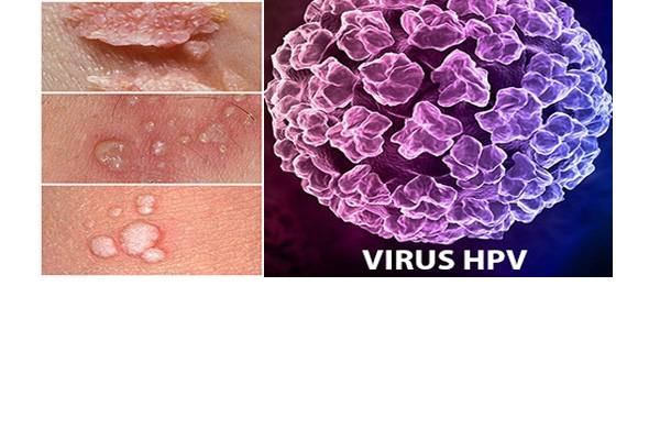 Bệnh hpv lây qua đường nào?