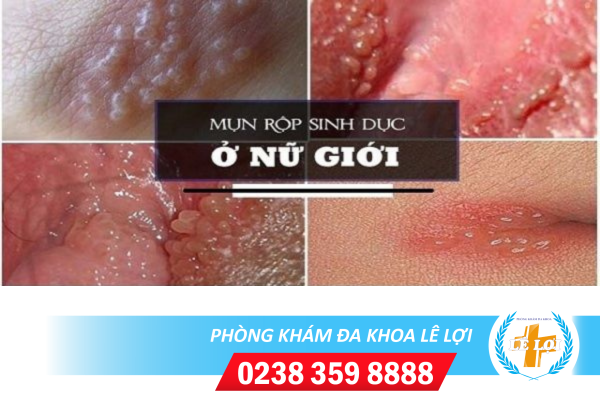 Nội dung đoạn văn bản của bạn (74)