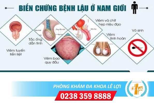 Nguyên nhân gây chảy mủ trắng dương vật