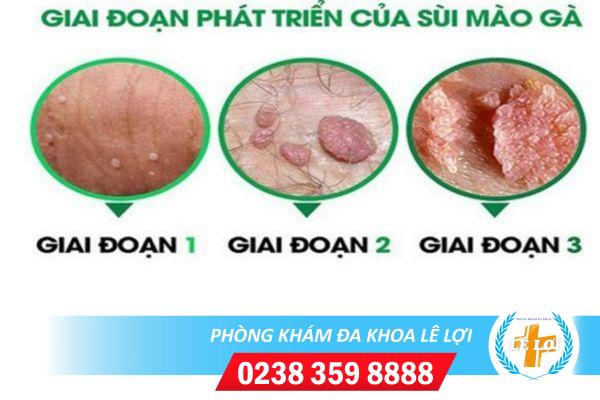 co-so-y-te-nao-dieu-tri-dom-trang-duong-vat-hieu-qua-1