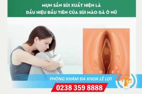 Dấu hiệu bệnh sùi mào gà ở môi bé và môi lớn