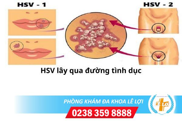 Mụn rộp sinh dục lây qua đâu?