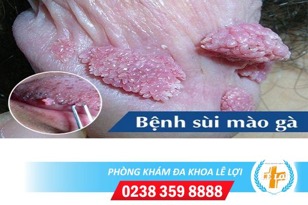 Nên xét nghiệm bệnh tình dục ở đâu uy tín?