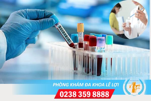 Xét nghiệm bệnh mụn rộp sinh dục ở âm đạo