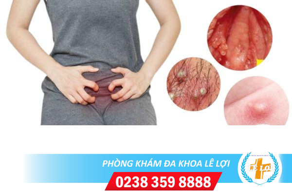 Nội dung đoạn văn bản của bạn (18)