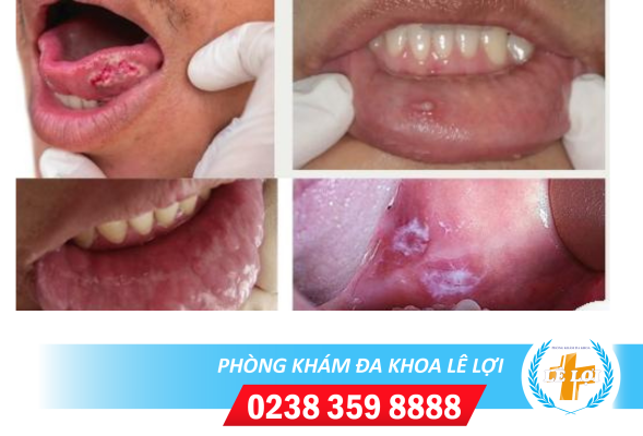 Nội dung đoạn văn bản của bạn (38)