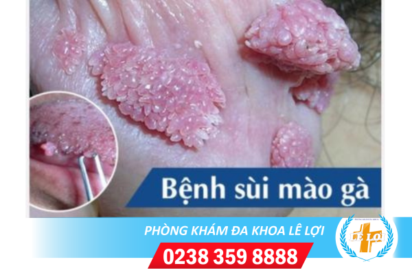 Nội dung đoạn văn bản của bạn (42)