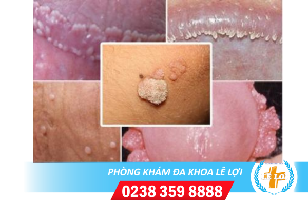 Nội dung đoạn văn bản của bạn (44)