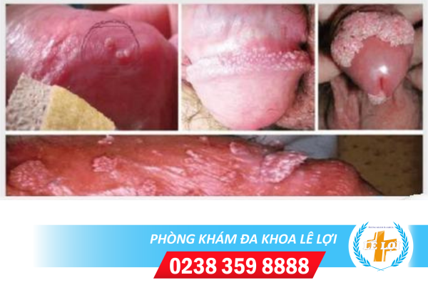 Nội dung đoạn văn bản của bạn (45)