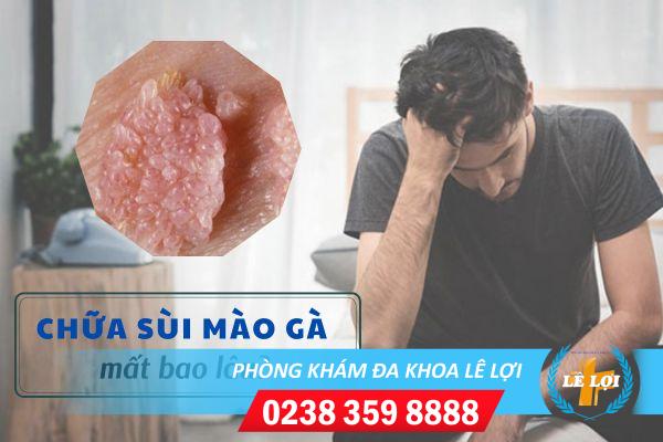 Chữa bệnh sùi mào gà mất bao lâu?