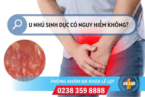 Dấu hiệu điển hình của u nhú sinh dục