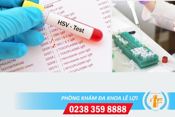 Xét nghiệm bệnh herpes chẩn đoán mụn rộp sinh dục thế nào?