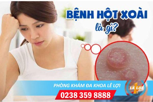 Bệnh hột xoài và những thông tin cần biết