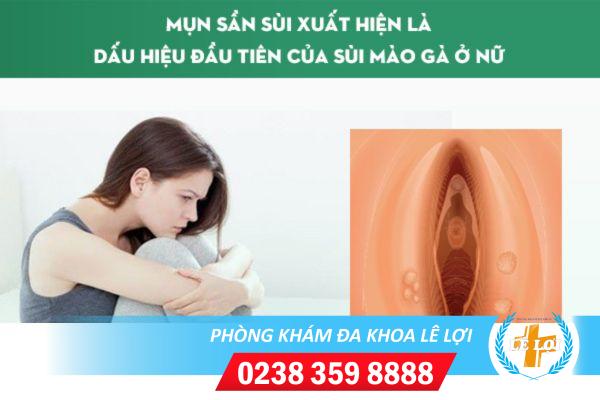 Thuốc chữa sùi mào gà giai đoạn đầu nhanh khỏi