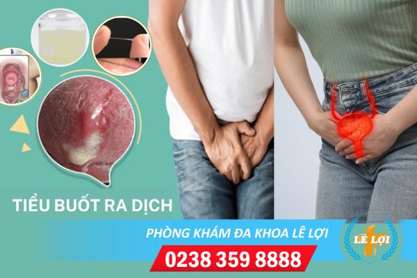 Tiểu buốt ra dịch là bị bệnh gì?